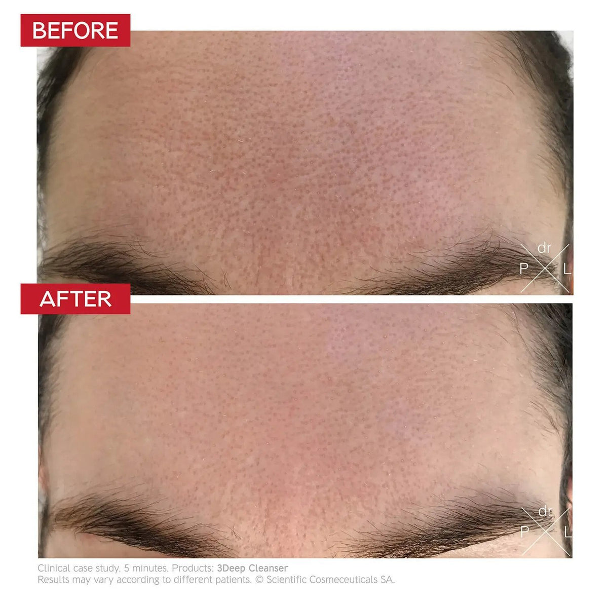 Dr Levy Switzerland Dr LEVY Switzerland | 3Deep Cell Renewal Micro-Resurfacing Cleanser - SkinShop