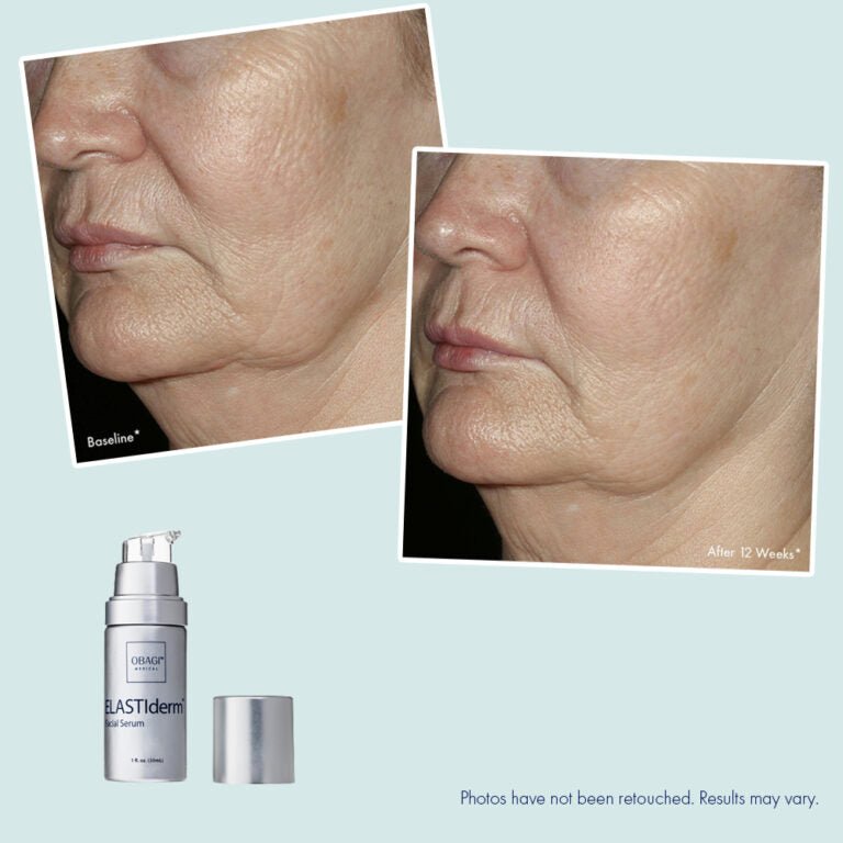Obagi ELASTIderm Facial Serum Clinical results SkinShop.ie