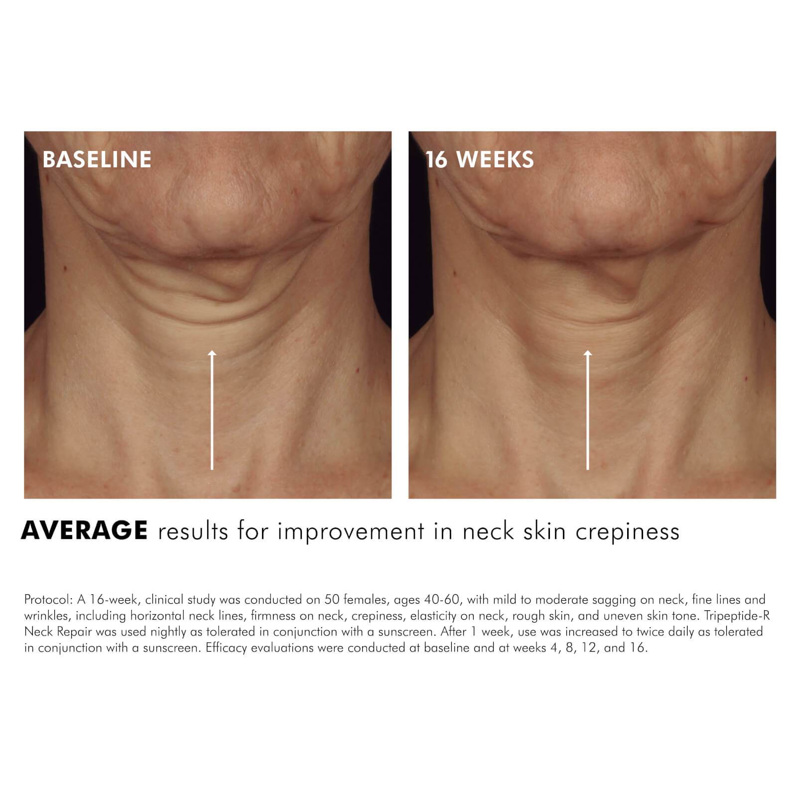 SkinCeuticals SkinCeuticals | Tripeptide-R Neck Repair - SkinShop