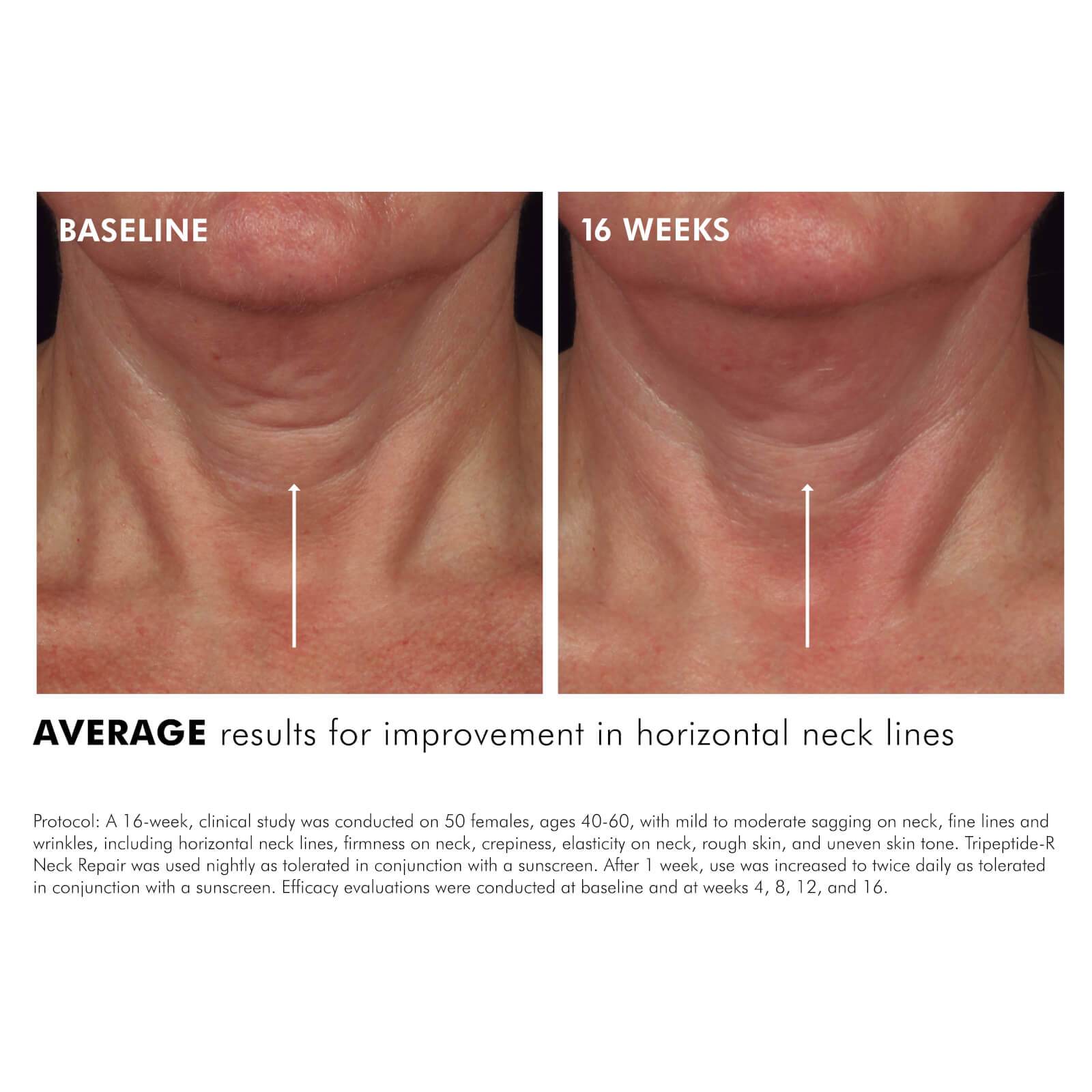 SkinCeuticals SkinCeuticals | Tripeptide-R Neck Repair - SkinShop