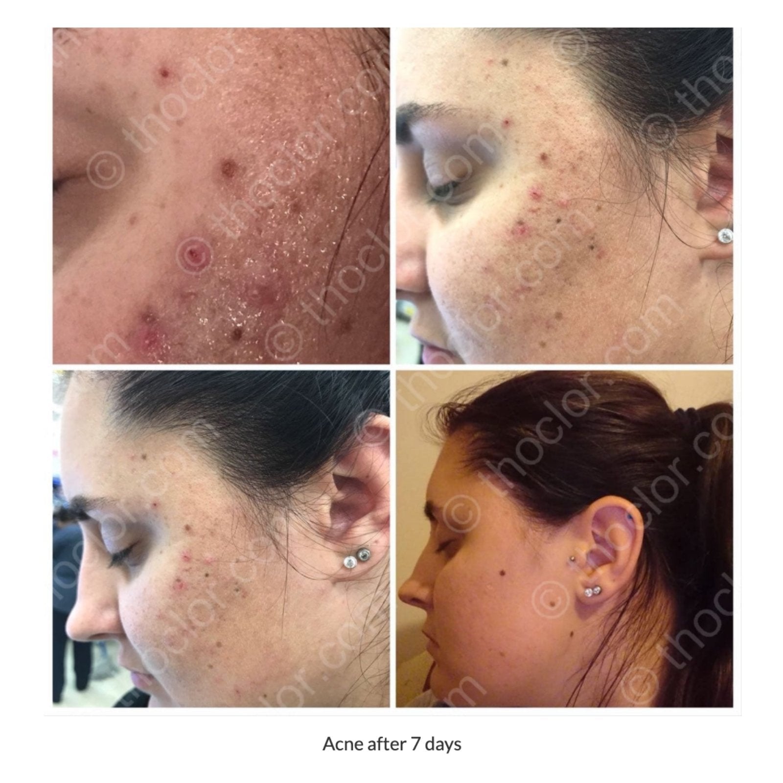 Thoclor Labs ThoClor Labs | GF2 Skin Rejuvenation - SkinShop