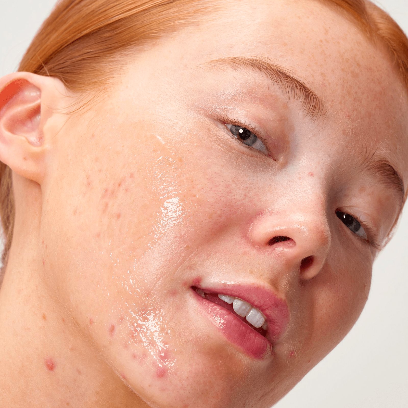 The Inkey List Apple Cider Vinegar Acid Peel | 30ml - SkinShop