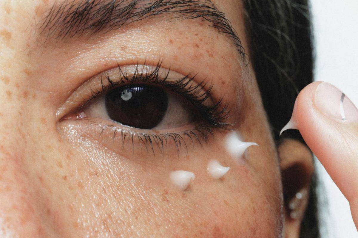 Close up of freckled skin with three dots of eye cream along the under eye and more cream on a fingertip, ready to apply