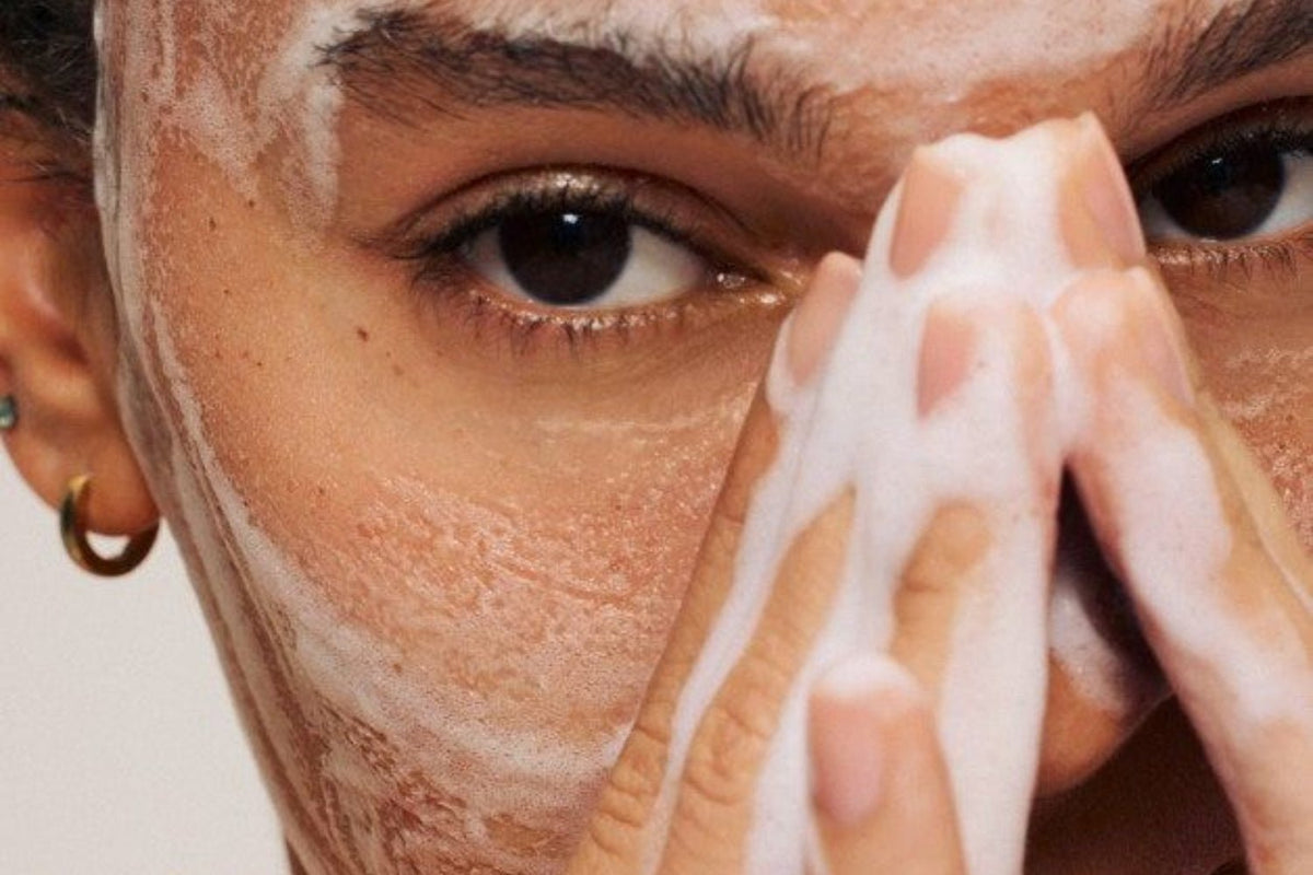 Here's how we start an acne routine: 5 cleansers you need to know - SkinShop