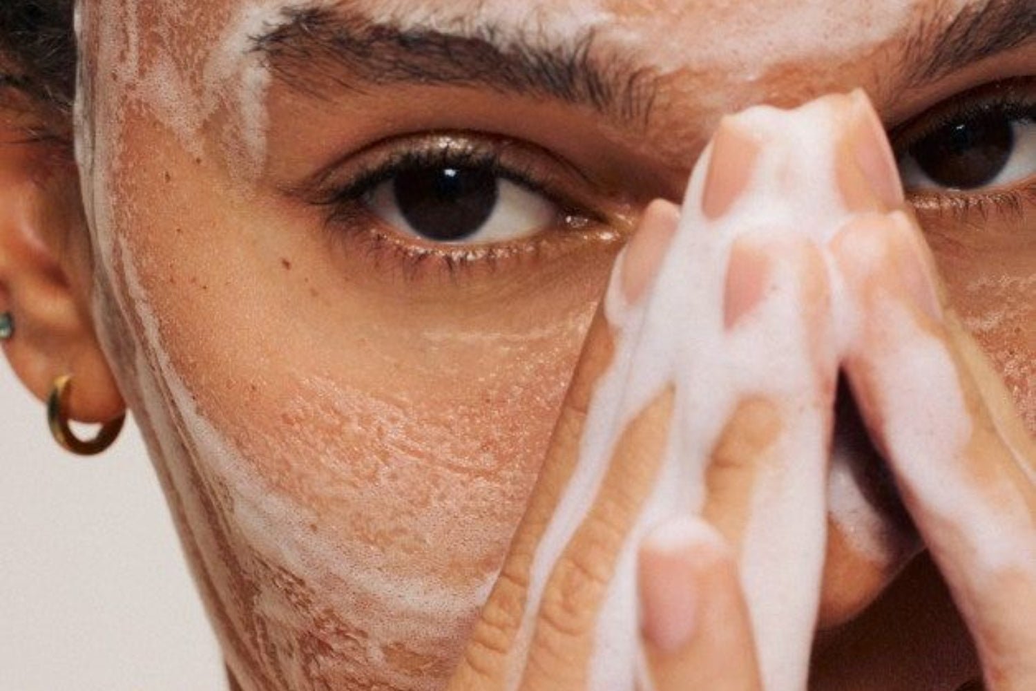 Here's how we start an acne routine: 5 cleansers you need to know - SkinShop