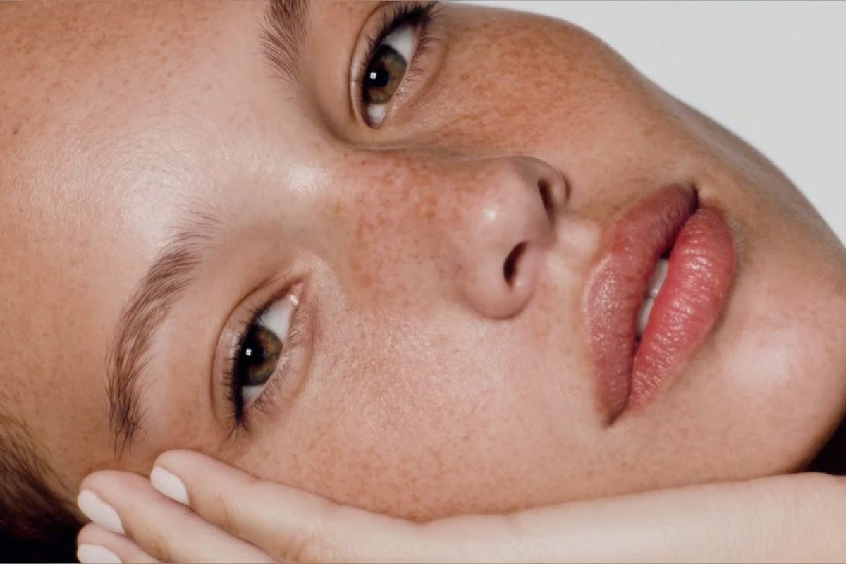 Why Your Pigmentation Is Not Fading And What Your Routine Is Missing - SkinShop