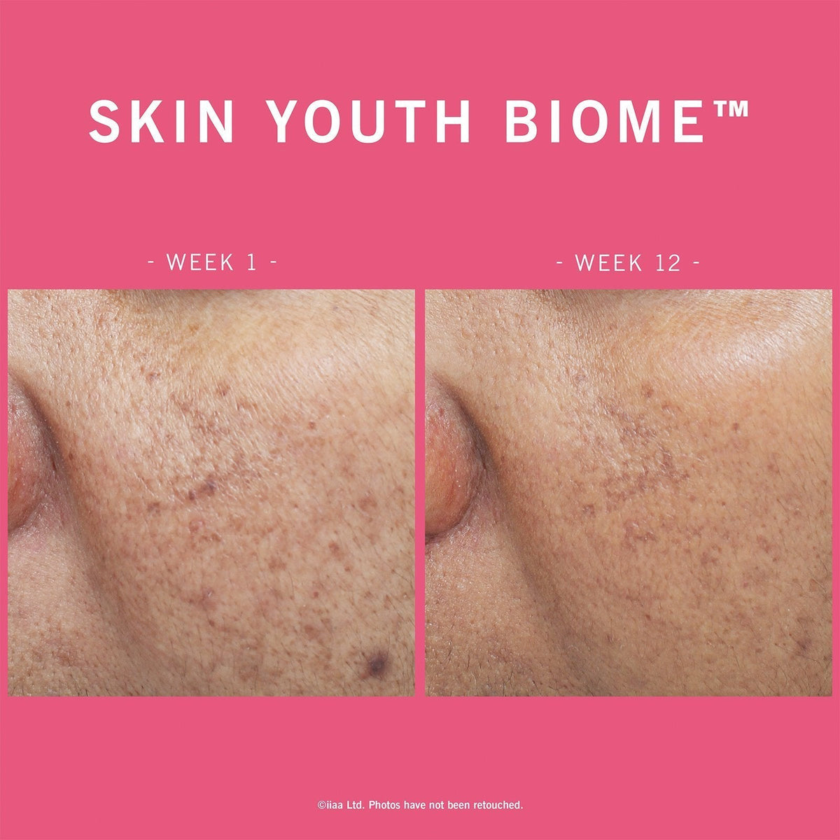 Advanced Nutrition Programme Advanced Nutrition Programme | Skin Youth Biome | 60 caps - SkinShop