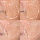 Close-up before and after skin showing smoother, softer wrinkles after 8 weeks of using Medik8 Liquid Peptides Advanced MP