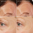 Before and after close-ups of forehead expression lines reduced 10 minutes after applying Medik8 Liquid Peptides Advanced MP