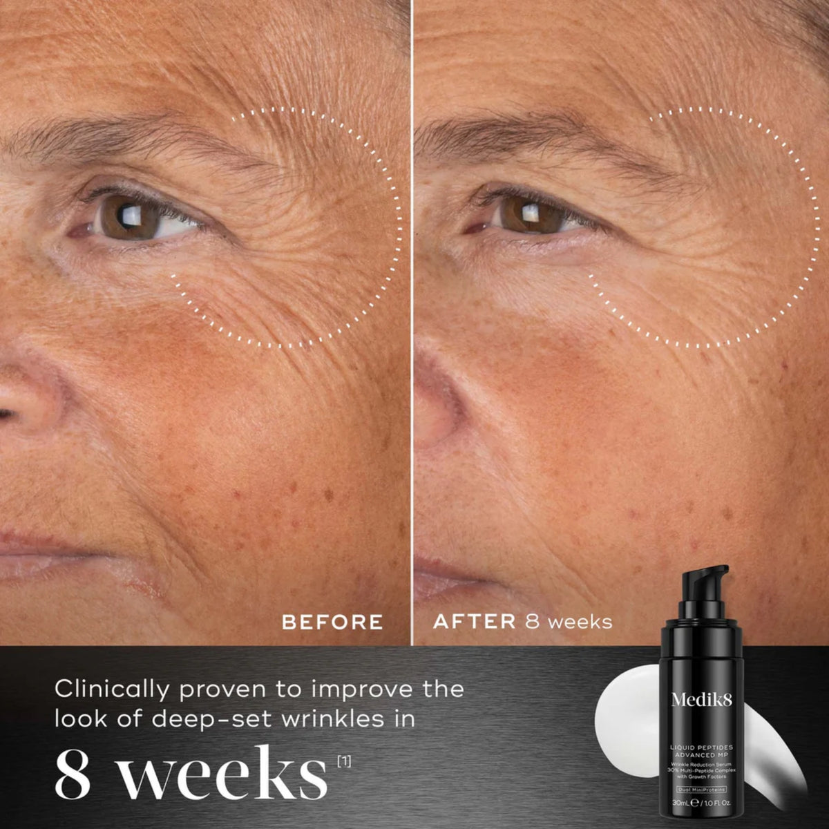 Graphic showing Medik8 Liquid Peptides Advanced MP clinically proven to improve the look of deep-set wrinkles in 8 weeks, with serum texture