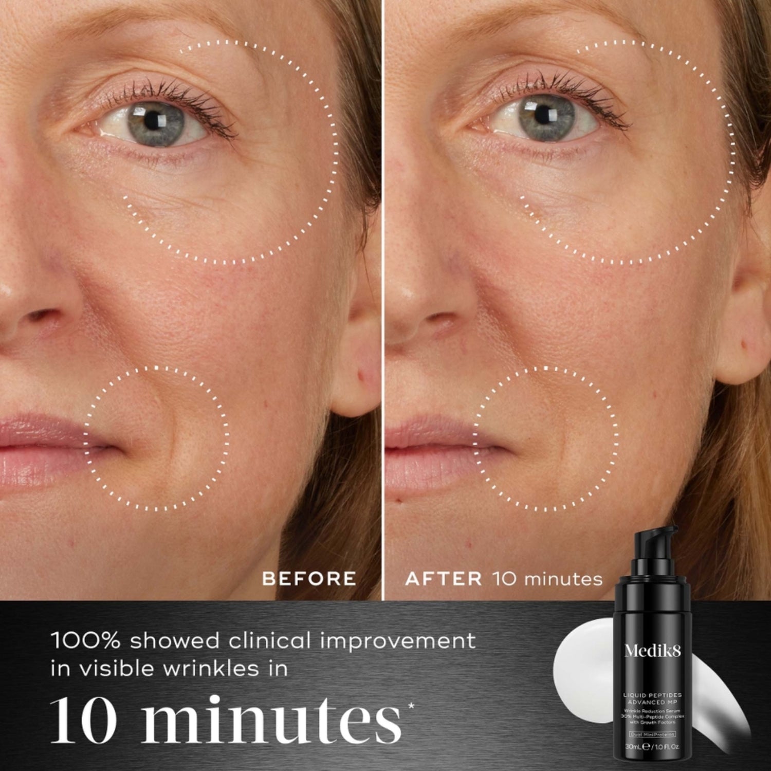 Before and after of a woman's face showing visibly reduced wrinkles 10 minutes after applying Medik8 Liquid Peptides Advanced MP