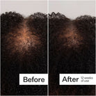 Act+Acre 0.25mm Scalp Dermaroller SkinShop