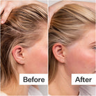 Act+Acre 4% Niacinamide Oily Scalp Serum SkinShop