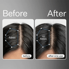 Act + AcreAct+Acre Cold Processed Scalp Renew 60mlSkinShop