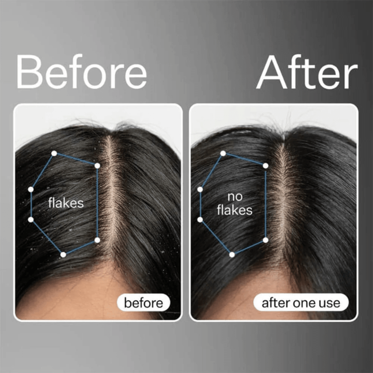 Act + AcreAct+Acre Cold Processed Scalp Renew 60mlSkinShop