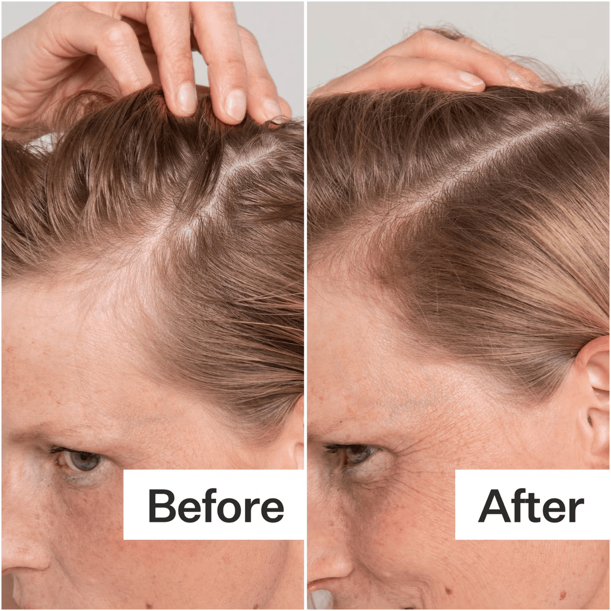 Act + AcreAct+Acre Cold Processed Scalp Renew 60mlSkinShop