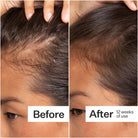 Act+Acre Stem Cell Scalp Serum 65ml SkinShop