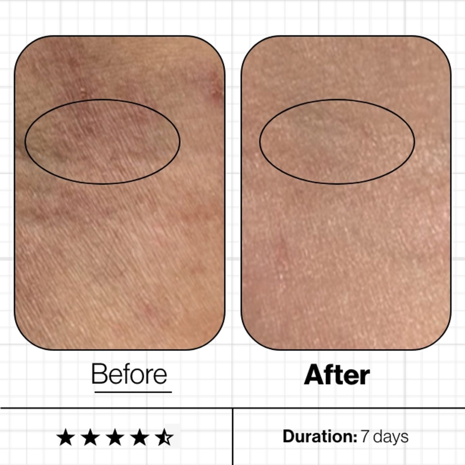 Advanced Nutrition Programme Advanced Nutrition Programme | Skin Moisture IQ 28 pods - SkinShop