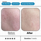 Advanced Nutrition Programme Advanced Nutrition Programme | Skin Moisture IQ 28 pods - SkinShop