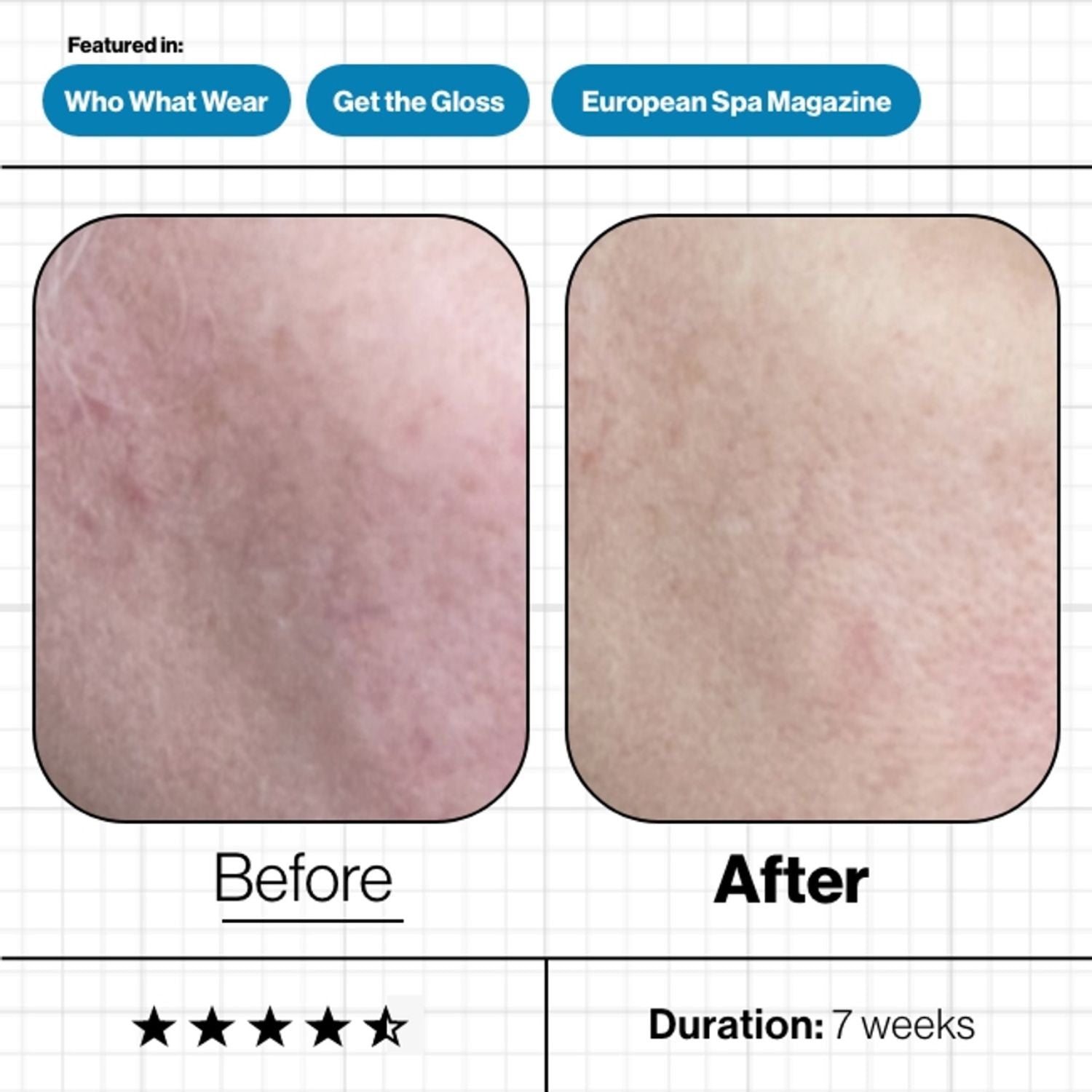 Advanced Nutrition Programme Advanced Nutrition Programme | Skin Moisture IQ 28 pods - SkinShop