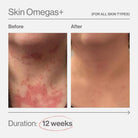 Advanced Nutrition ProgrammeAdvanced Nutrition Programme Skin Omegas+ 180 capsSkinShop