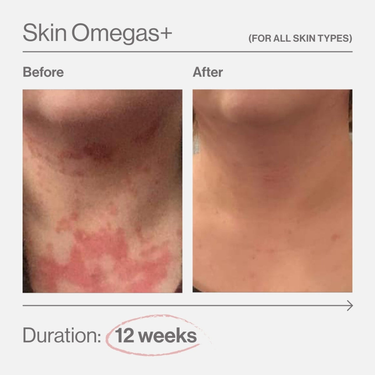 Advanced Nutrition ProgrammeAdvanced Nutrition Programme Skin Omegas+ 180 capsSkinShop