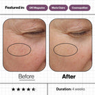 Advanced Nutrition Programme Advanced Nutrition Programme | Skin Ultimate 28 Day Supply - SkinShop