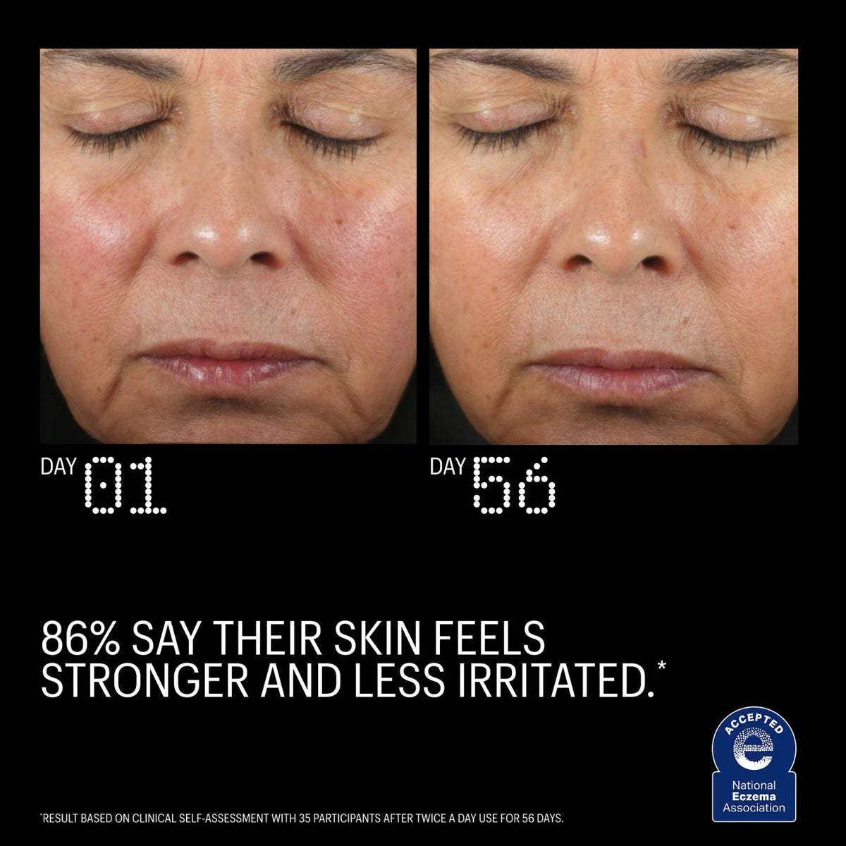Allies of SkinAllies of Skin Copper Tripeptide & Ectoin Advanced Repair Serum 30mlSkinShop