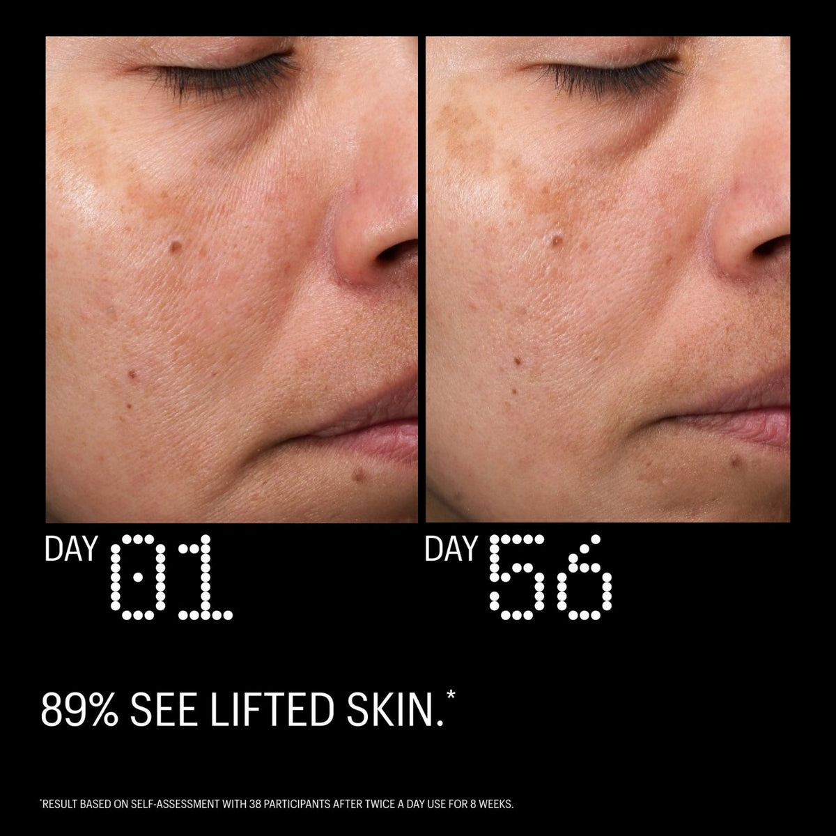 Allies of SkinAllies of Skin Multi Peptides & Growth Factors Advanced Lifting Serum 30mlSkinShop