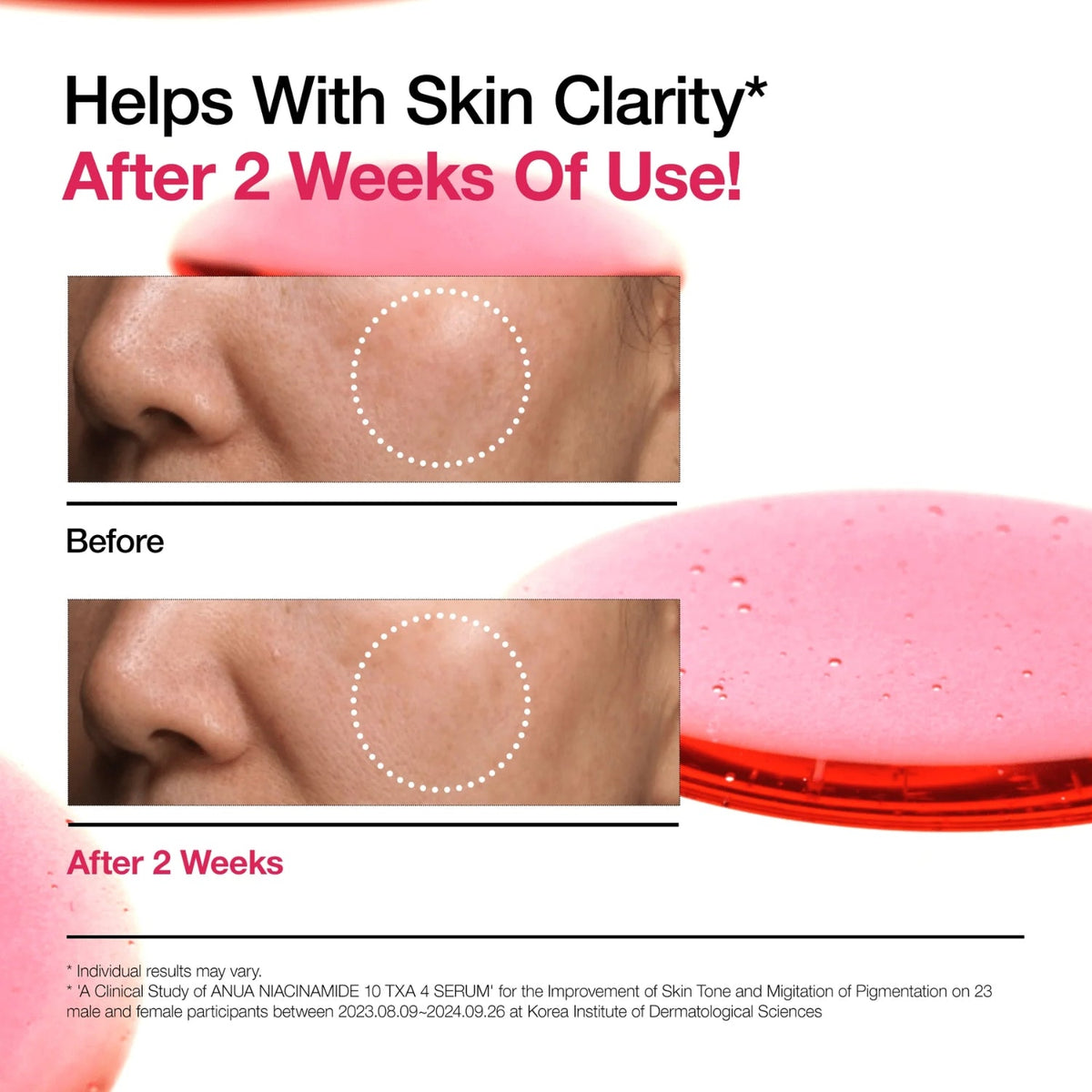 AnuaAnua Niacinamide 10% + TXA 4% Dark Spot Correcting Serum 30mlSkinShop