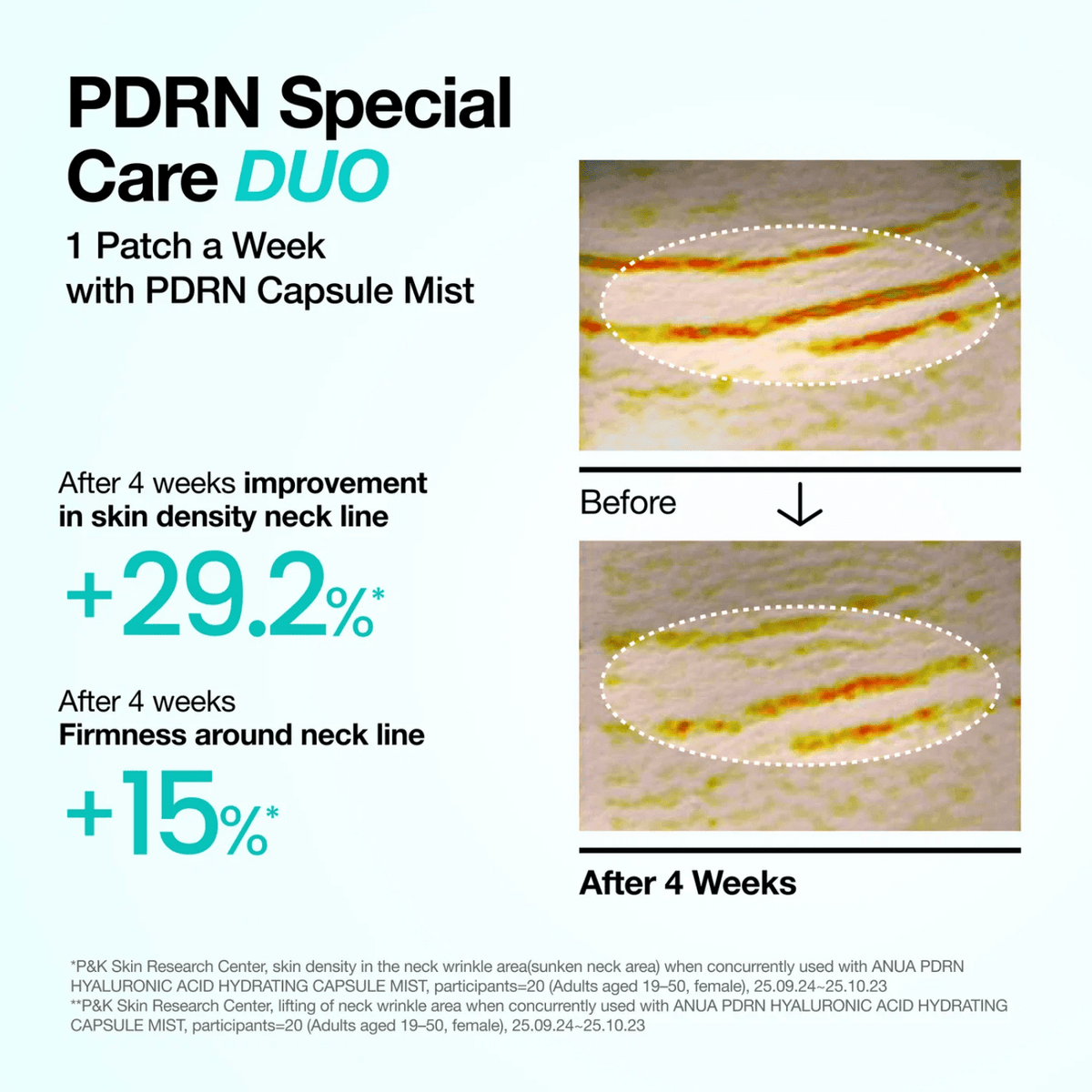 Anua PDRN Collagen Melting Patch for Neck (4EA) SkinShop