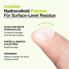 AnuaAnua Ultra Thin Spot Cover Patch (75 pieces)SkinShop