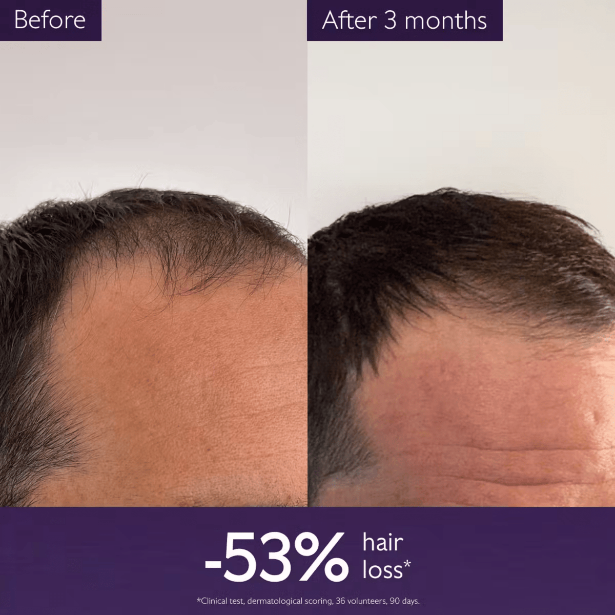 Caudalie Anti-Hair Loss Serum 50ml SkinShop