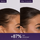 Caudalie Anti-Hair Loss Serum 50ml SkinShop