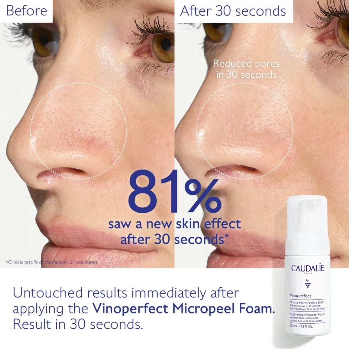CaudalieCaudalie Vinoperfect Brightening Micropeel Foam 100mlSkinShop
