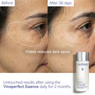 CaudalieCaudalie Vinoperfect Concentrated Glycolic Essence 100mlSkinShop