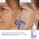 CaudalieCaudalie Vinoperfect Dark Spot Brightening Serum 50mlSkinShop