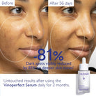 CaudalieCaudalie Vinoperfect Dark Spot Brightening Serum 50mlSkinShop