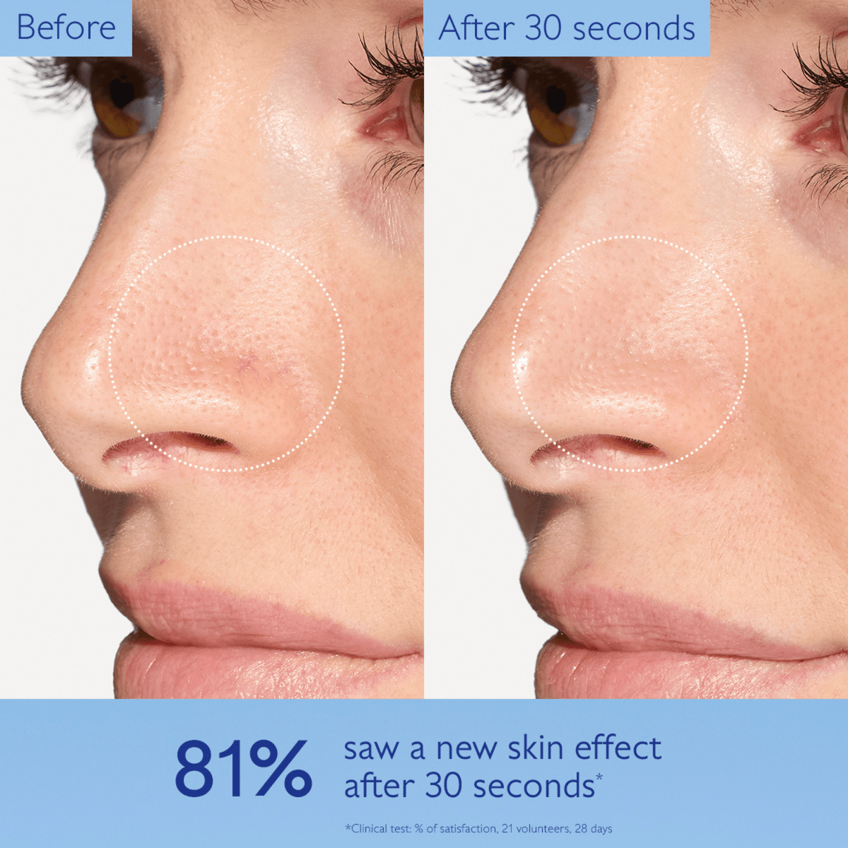 CaudalieCaudalie Vinoperfect Dark Spot Correcting DuoSkinShop