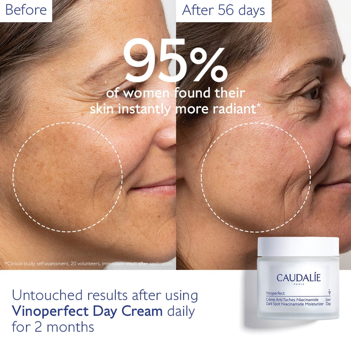CaudalieCaudalie Vinoperfect Dark Spot Moisturizer 50mlSkinShop