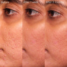 CaudalieCaudalie Vinopure Blemish Control Salicylic Serum 30mlSkinShop