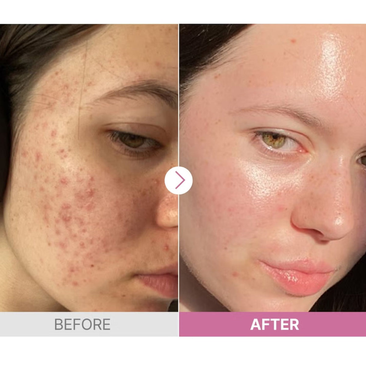 COSRXCOSRX The Niacinamide 15 Serum 20mlSkinShop