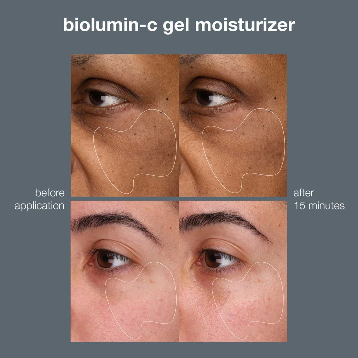 DermalogicaDermalogica BioLumin-C Gel Moisturiser 50mlSkinShop