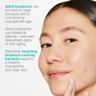 DermalogicaDermalogica Breakout Biotic Moisturiser 50mlSkinShop