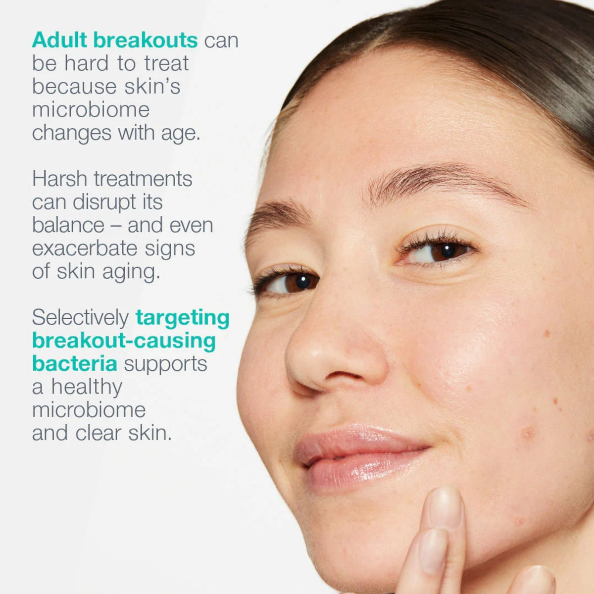DermalogicaDermalogica Breakout Biotic Moisturiser 50mlSkinShop