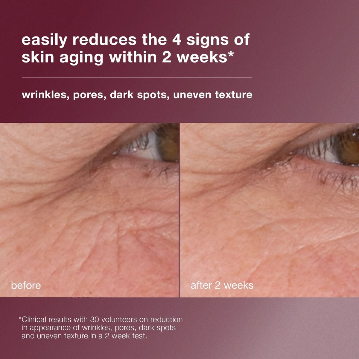DermalogicaDermalogica Dynamic Skin Retinol Serum 30mlSkinShop
