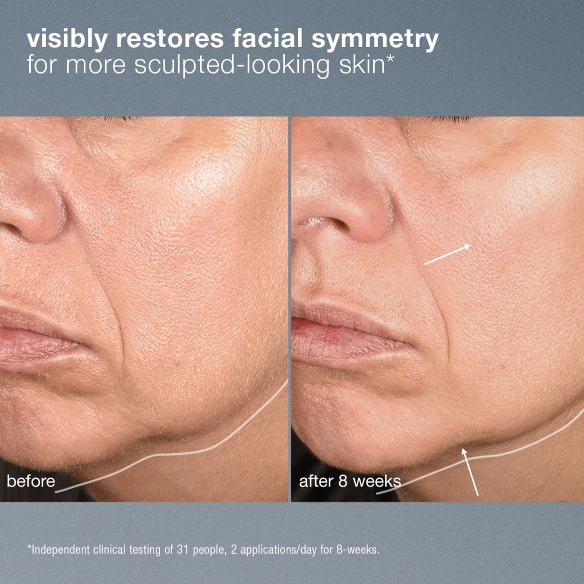 DermalogicaDermalogica Neurotouch Symmetry Serum 30mlSkinShop