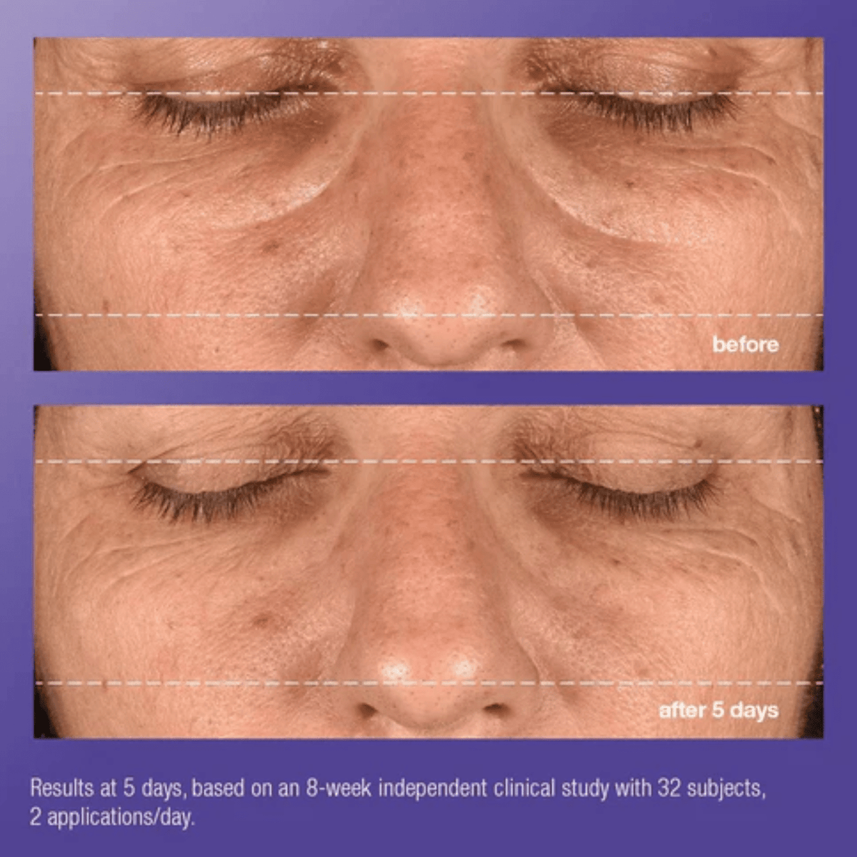 DermalogicaDermalogica Phyto Nature E² Regenerating Daily Exosome Leave-On TreatmentSkinShop