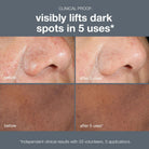 Dermalogica Dermalogica | PowerBright Dark Spot Peel 50ml - SkinShop