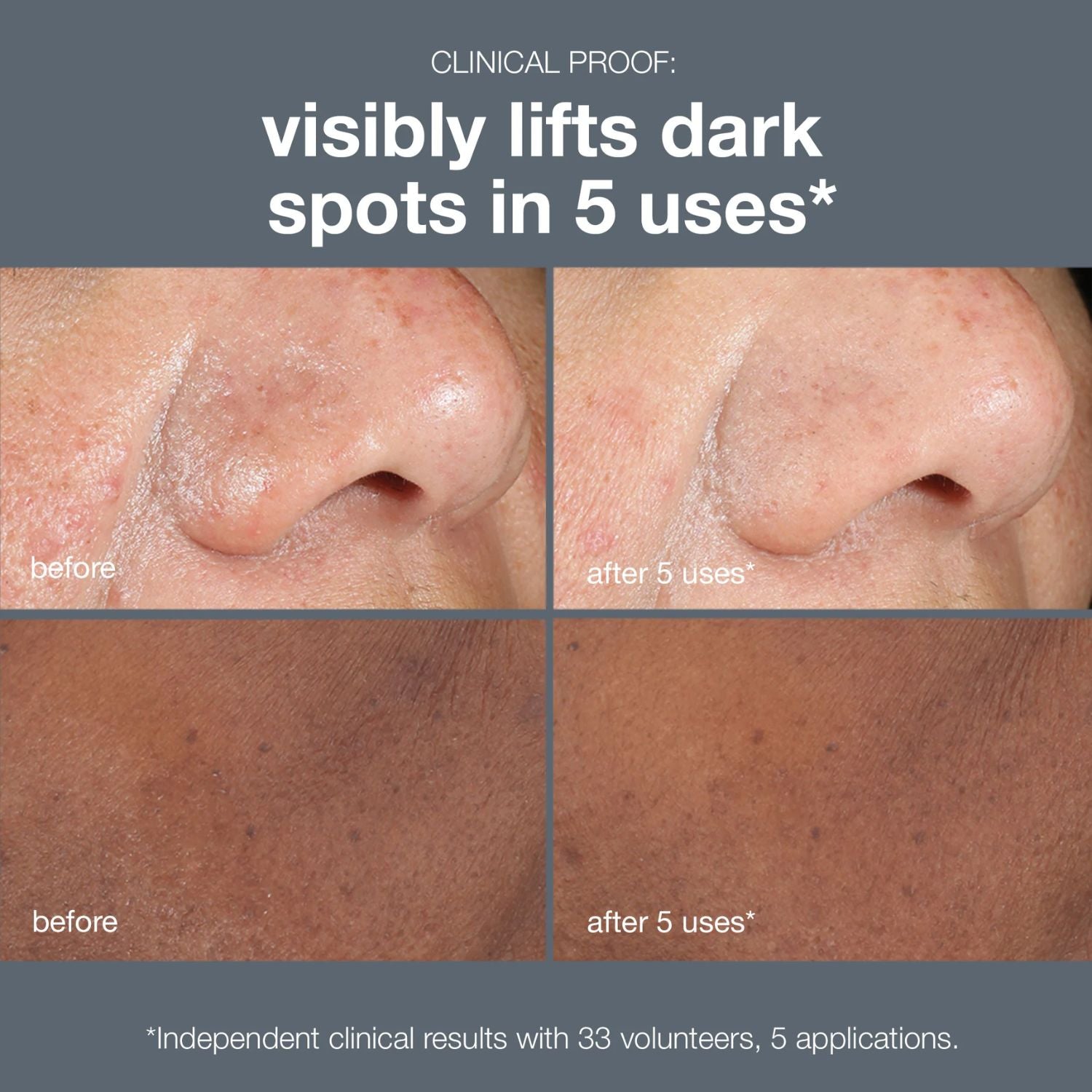 Dermalogica Dermalogica | PowerBright Dark Spot Peel 50ml - SkinShop